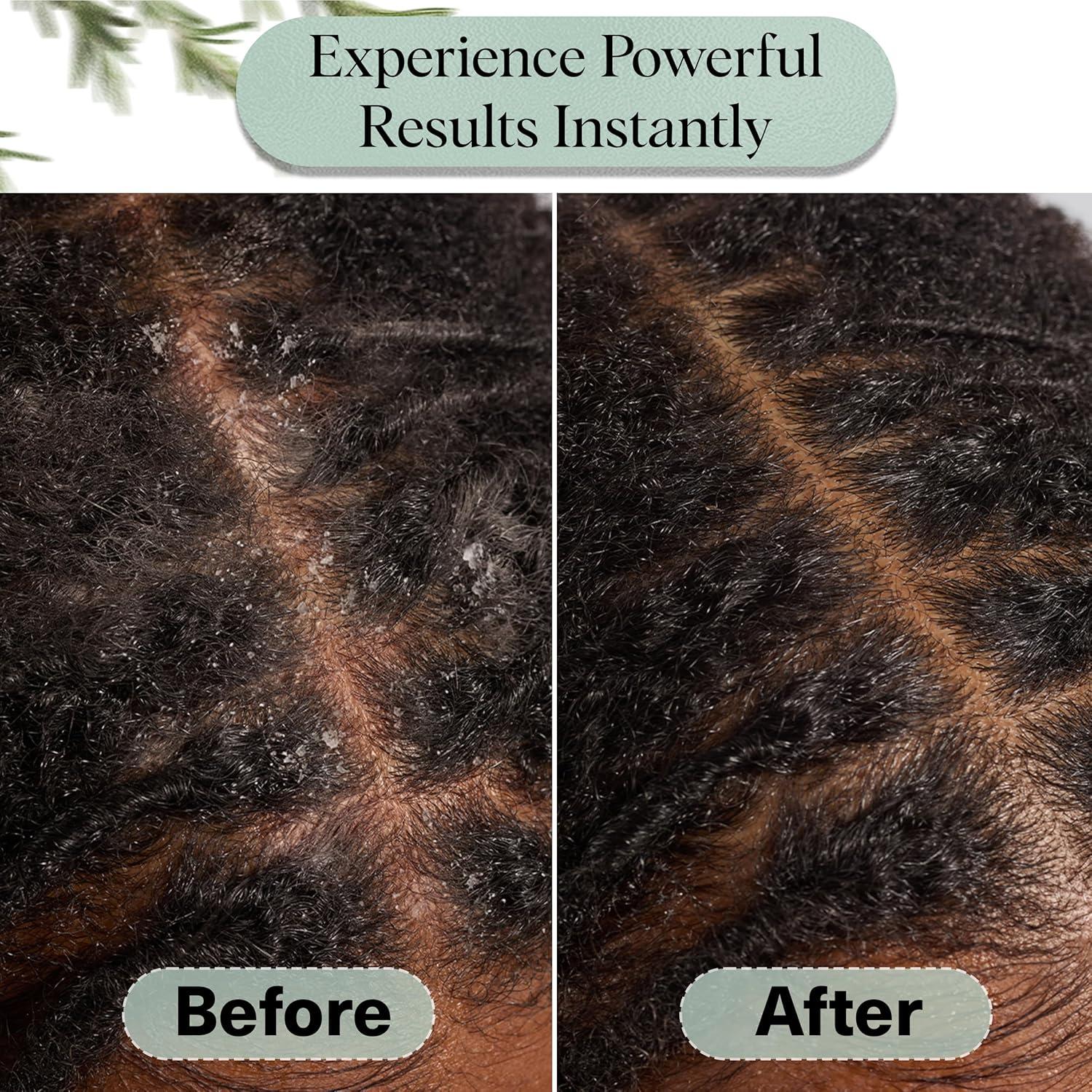 imageKitsch Rosemary Oil for Hair Growth Hair Oil with Biotin Castor ampamp Jojoba PreWash Scalp oil for Hair Care Lavender Scent 10mL034 Fl Oz Pack of 1